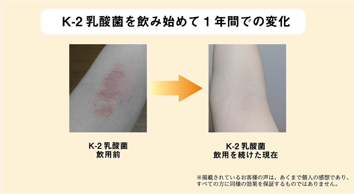 K-2乳酸菌を飲み始めて1年間での変化