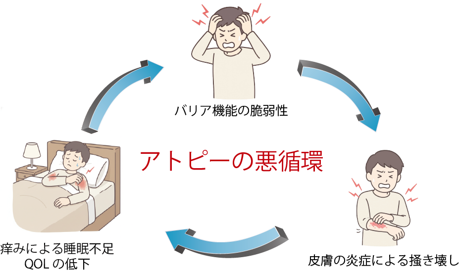 痒みから始まる悪循環の図