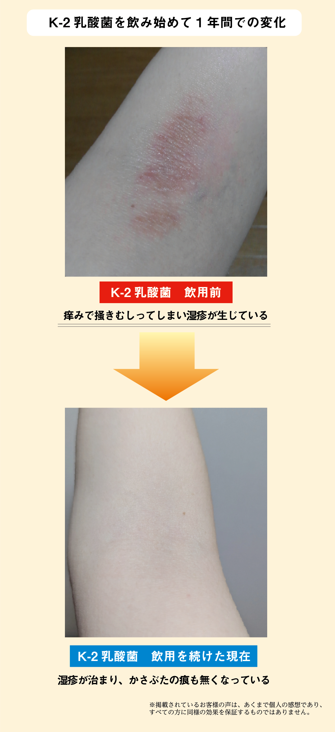 K-2乳酸菌を飲み始めて1年間での変化